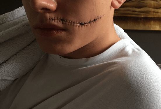 Victim Deansgate.png